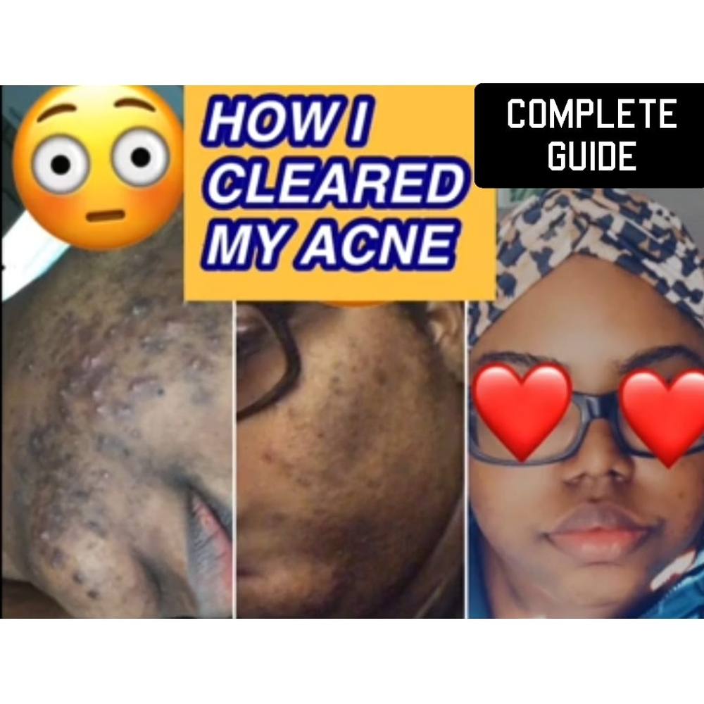 Skincare Guide